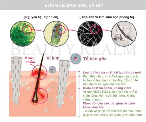Vi kim tế bào gốc là gì